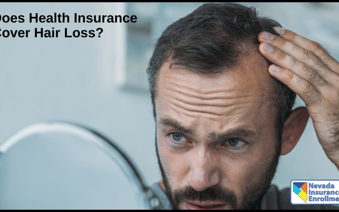 Does Health Insurance Cover Hair Loss?