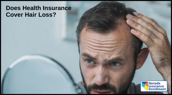 Does Health Insurance Cover Hair Loss?